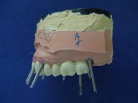 /album/galeria-de-fotos/a1-1-jpg/